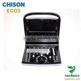 Medical Chison B/w 2d Portable Ultrasound Chison Eco3