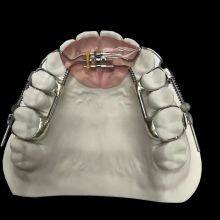 Orthodontic-Appliance China Dental Laboratory - Outsourcing Dental Lab thumbnail-3