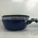 New Arrival Aluminum Press Non-stick Cookware Set Forged Die Cast Stock Pasta Noodle Cooking Soup Pot Casserole thumbnail-2