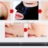 50ml Shills Deep Cleaning Peel-off Mask Purifying Blackhead Black Facial Mask thumbnail-3