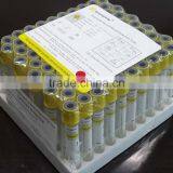 Vacutainer Gel Tube With Clot Activator 3.5ml ( Yellow Cap ) thumbnail-6
