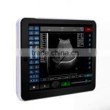 Best Touch Screen Tablet Ultrasound Machine From Manufacturer thumbnail-2