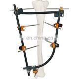 Competitive Price Orhtopedic External Fixator for Tibia Surgery thumbnail-2