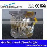 Transparant deciduous Teeth Model Teaching And Hospital Demonstration