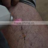 (ISO13485/CE) Laser Diode 808 Permanent Hair Removal Machine With Freon Cooling System OB-DH 03 thumbnail-5