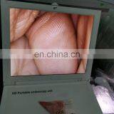 MY-P038B Medical Endoscope 17 Inch HD LCD Screen Portable Endoscopic Camera thumbnail-4