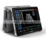 Professional Ultrasound Devices With 3d thumbnail-3