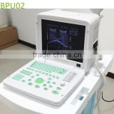 2016 Latest Ultrasound portable machine /ultrasound Scanner- BPU02