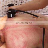 Meridian Therapy Hammer Physiotherapy Slimming Massager Electro Acupuncture Device thumbnail-5