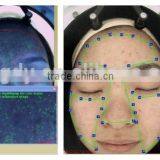 Newest!!! CE Approval Esthetic Equipment Skin Analysis/skin Analyzer thumbnail-5