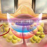 Touch Screen Viora Reaction thumbnail-2