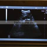 Hot Sale Black Color 10.1-inch High-resolution TFT LCD Portable pc Ultrasound Machine for Scan thumbnail-2