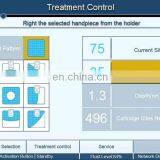 New Product Liposonic Hifu / Cheap Lipo / Hifu Liposuction Machine thumbnail-4