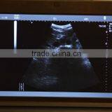 Cheap Price 10 Inch Laptop Ultrasound Scanner Convex Linear Micro-convex Rectal Transvaginal Probe thumbnail-5