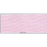 3-Conduct Electrocardiograph Paper