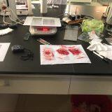 Super Absorption Polymer Disposable Hygienic Raw Materials-sap thumbnail-2