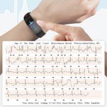 Monitoring Watch Intelligent Health Electrocardiogram and Blood Pressure Monitoring thumbnail-5