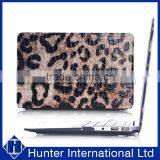 Superior Fancy For Macbook 11" Leather PC Cover