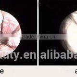 1ms-5000ms Private Health Beautify Vagina CO2 Fractional Laser Vaginal Tightening Machine 0.1-2.6mm thumbnail-6