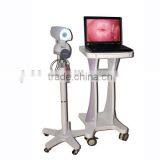 CE & ISO Approved Electronic Digital Video Colposcope on Sale thumbnail-2