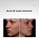 3in1 Machine Best Professional Multifunction 755nm Alexandrite Laser and Long Pulsed Laser 1064nm New Laser From Popipl thumbnail-5