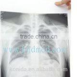 Agfa X-ray Film 14x17 Blue Medical Film 8x10in Made in Chinafilm for Hospital Agfa X-ray Film thumbnail-5
