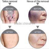 Best China Hot Sale!! Super Fast Color Touch Screen Yag Laser Tattoo Removal Beauty Machine 10HZ thumbnail-6