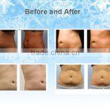Cellulite Reduction FIve Handpieces Cryolipolysis Machine And Two Handpieces Can Work Together / Cryolipolysis Fat Freeze Slimming Machine Lose Weight thumbnail-6