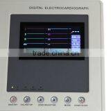 5-inch New Digital Portable 3 Channel ECG/ EKG Machine on Sale thumbnail-5