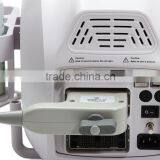 2015 New Full Digital Portable Ultrasound Scanner (PC) thumbnail-5