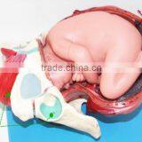 Training Model of Fetal Production Process in the Model of Term Fetus thumbnail-1