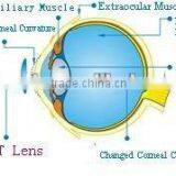 Suit for the Patients Who is With Presbyopia Contact Lens thumbnail-1