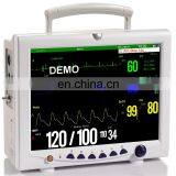 MY-W003C Medical Monitoring Portable 12 Inch Veterinary Vital Signals Multiparameter Patient Monitor Price thumbnail-5