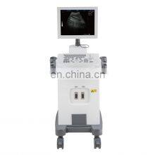 Portable Medical Ultrasound Instruments 15 Inch B/W Full- Digital 2D Ultrasound Trolley Ultrasound Scanner Machine thumbnail-5