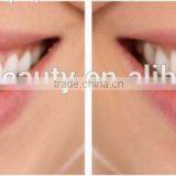 AYJ-J003A Laser Teeth Whitening Machine /teeth Whitening Laser thumbnail-6