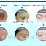 Hori Naevus Removal F12 Fast Effective Laser Eyebrow 1-10Hz Pigment And Tattoo Removal Machine Pigmented Lesions Treatment thumbnail-5