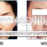 Professional Young Girl Tube Led 12v Light Tube8 Japan Xxx 1200m Led Pool Light With CE Certificate thumbnail-5