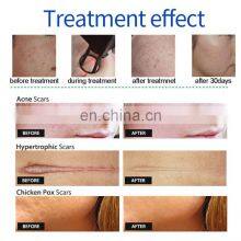 Fractional Co2 Laser Skin Resurfacing Co2 Fractional Laser Cost Medical Fractional Laser Co2 thumbnail-5