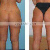 Fat Cavitation Device For Home/weight Loss Machine/rf With CE thumbnail-6