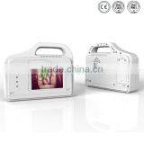 YSVV200 Guanghzou Hot Vein Illumination Device Price thumbnail-1