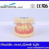 Dental Extraction Model School Teaching Model Teeth Model