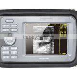HandScan H8 Portable Handheld Palm Human B/W B Ultrasound Machine With Various Probe-Shelly thumbnail-2