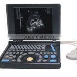 10.4 Inch Ultrasonic B Laptop Ultrasound Scanner With Battery Optional Printer thumbnail-1
