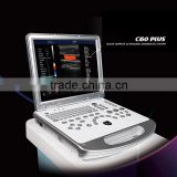 ultrasound machine ,ultrasound machine price,ultrasound scanner