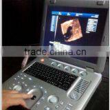 (MSLCU18)3D 4D Handheld Color Doppler Medical Ultrasound Scan Machine thumbnail-5