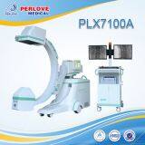 Digital x Ray Machines Portable PLX7100A