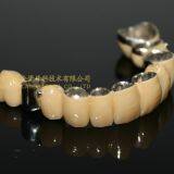 Dental Crown Composite, Dental Teeth, Dental Prosthesis, Laboratoire Dentaire, Dentallabor, Laboratorio Dental, Dental Laboratory, Shenzhen LJ Dental Lab China thumbnail-4