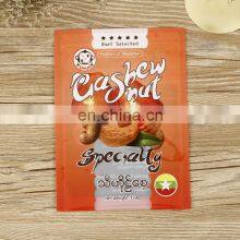 China Supplier Custom Logo Ziplock Plantain Chips Packaging Bags thumbnail-4