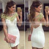 New Fashion Ladies Dress Free Prom Dress Dress Halter Lace Sexy Dress thumbnail-1