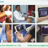 10MHz Apple Ios Android Wireless Ultrasound Probes Ultrasound Scanner thumbnail-4